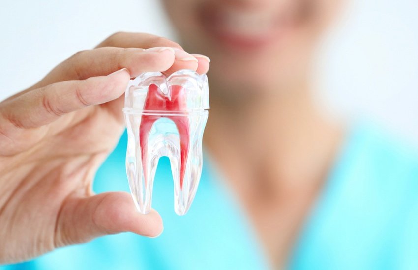 root canal therapy