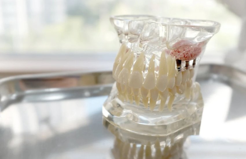 bone grafting