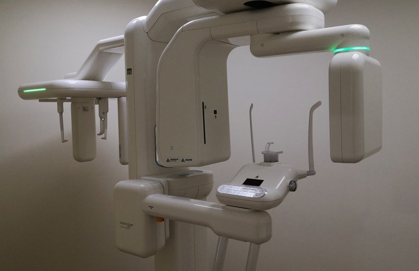 3d cone beam x ray